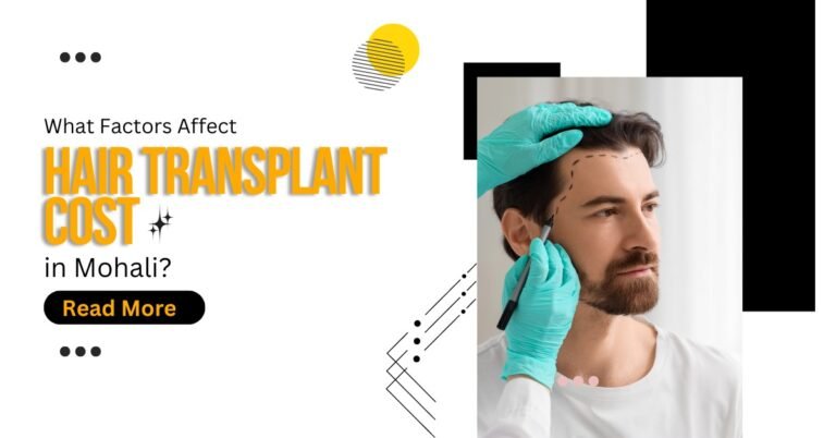 What Factors Affect Hair Transplant Cost in Mohali?