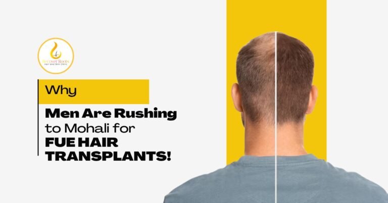 Why FUE Hair Transplant Is the Most Preferred Technique in Mohali