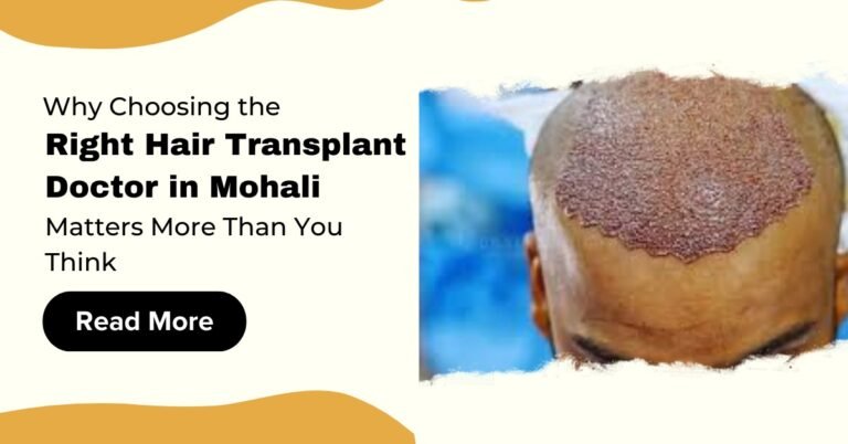 Why Choosing the Right Hair Transplant Doctor in Mohali Matters More Than You Think